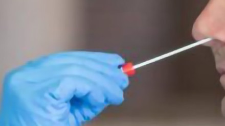 Nuova infezione dalla Cina, torna l’aviaria?